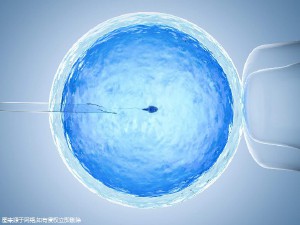 培养箱